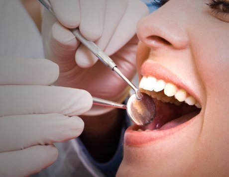 IMPLANTS Teeth care